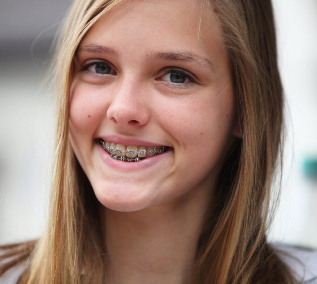 young teenage girl smiling with braces on teeth, blurry background