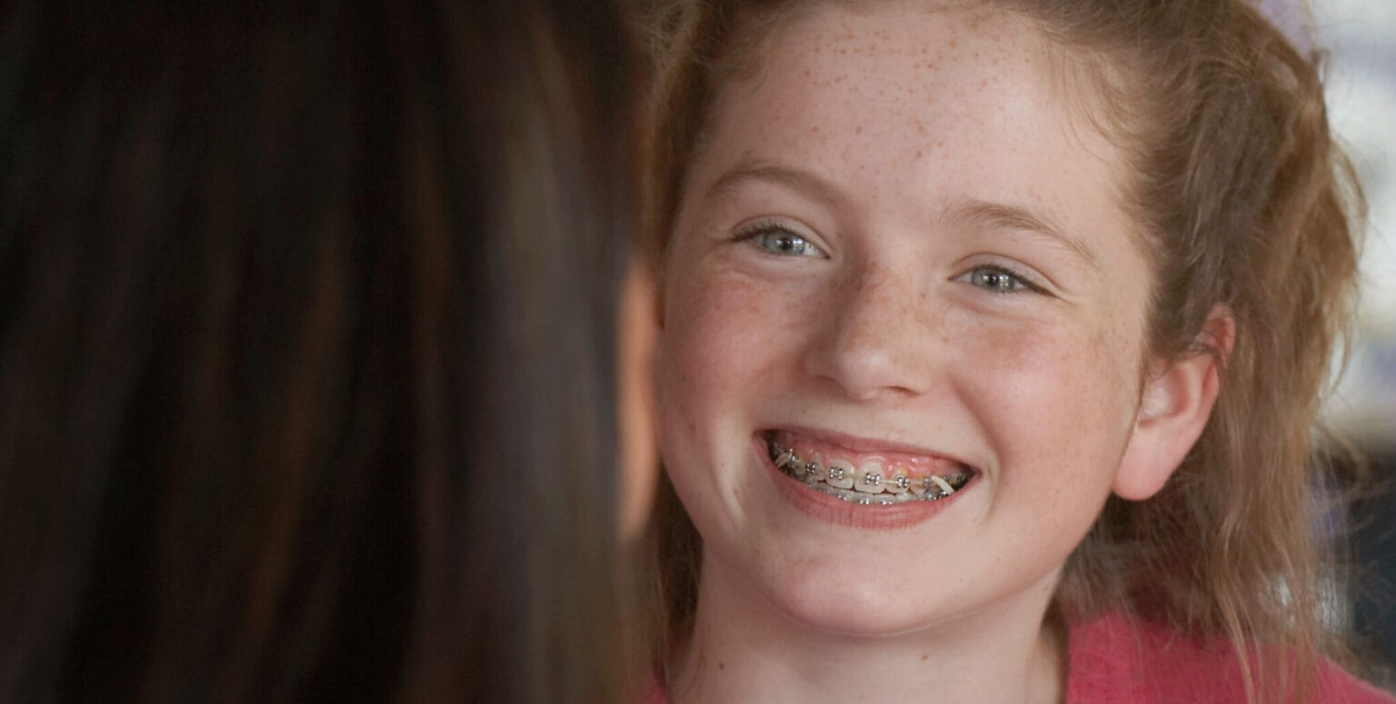Everything You Need to Know About Rubber Bands for Braces Greater